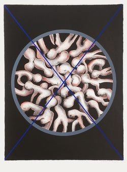 Surpopulation
