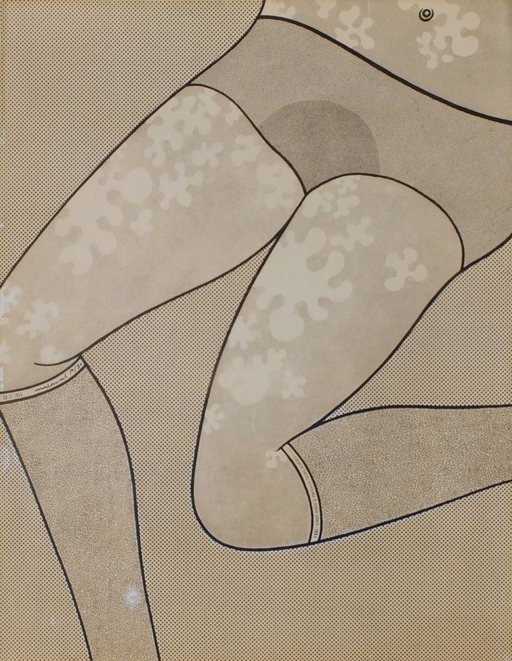 Anne : genou gauche et pubis (les tâches blanches)