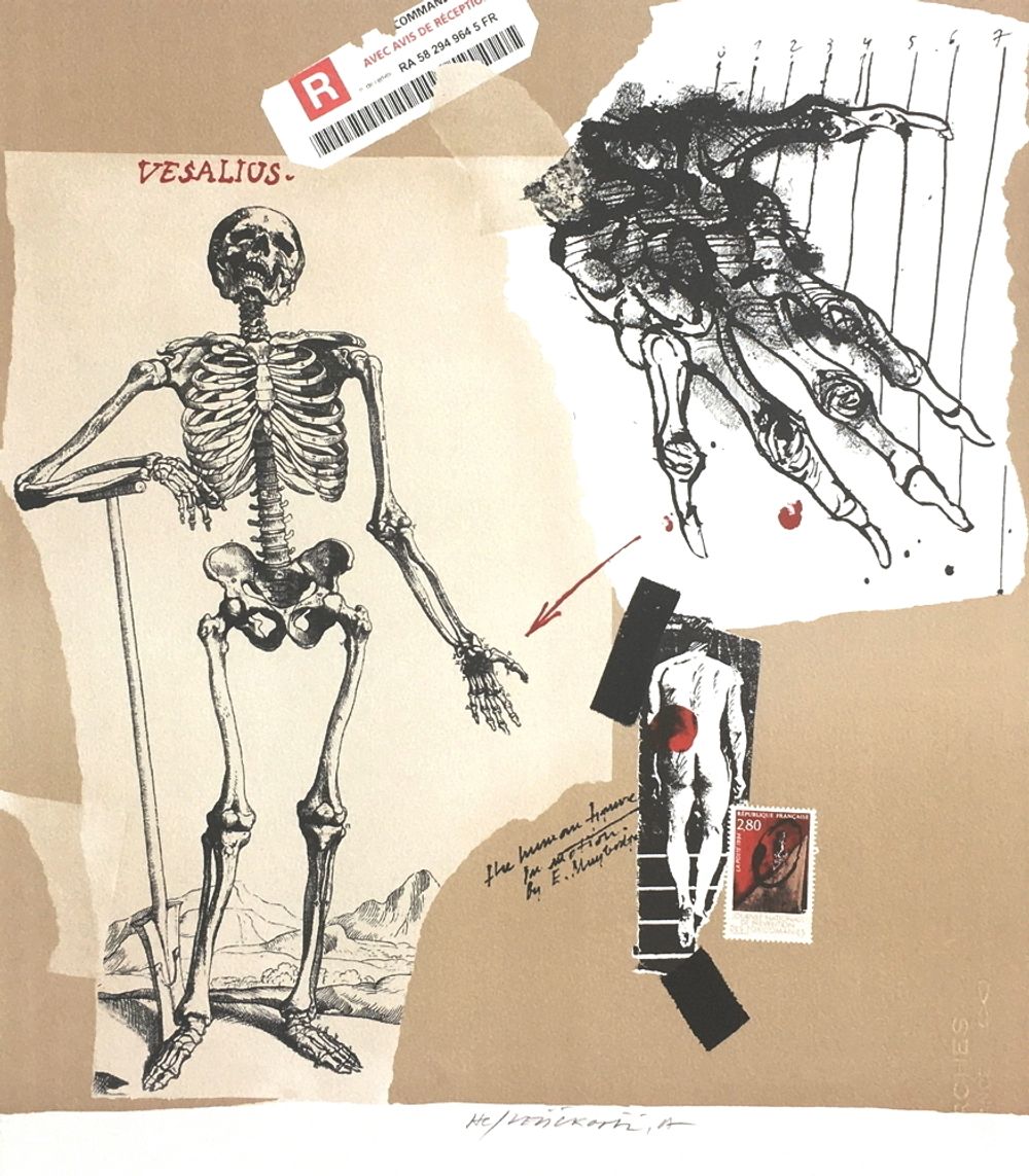 Vesalius