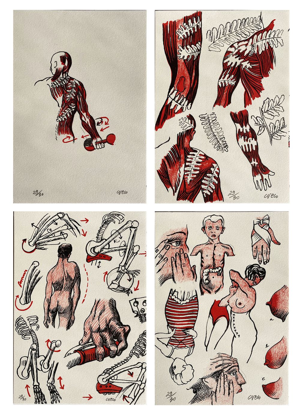 Douleurs en fougères - 18 lithographies dont 5 signées — vue 2